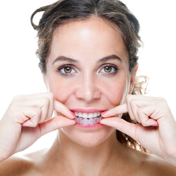 woman with Invisalign aligner